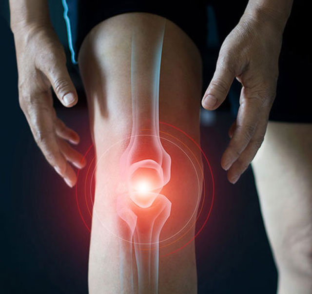 Tratamento pós-operatório de joelho